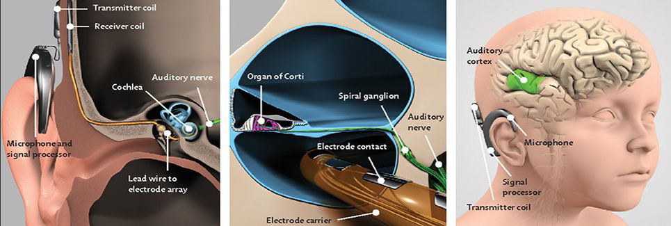 Biomedical Engineering - Bioengineering of Neurosensory Systems